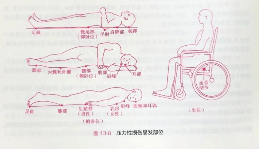非感染性爛尾如何護(hù)理，“非感染性爛尾”如何護(hù)理