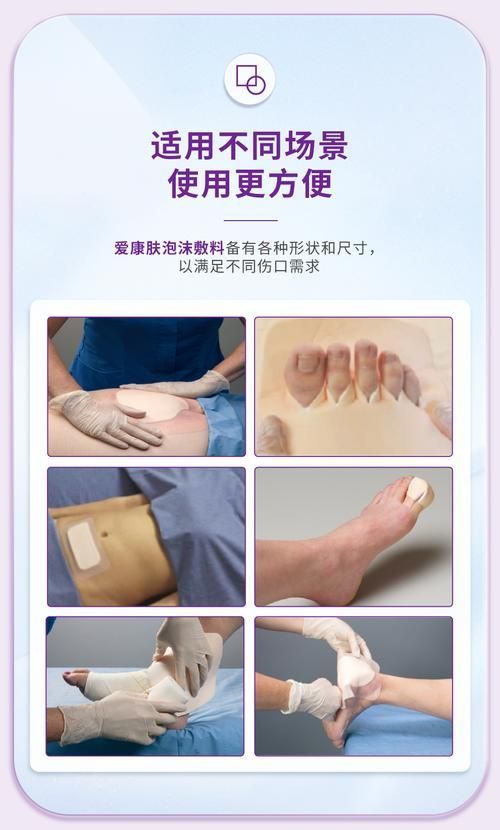 非感染性爛尾如何護(hù)理，“非感染性爛尾”如何護(hù)理