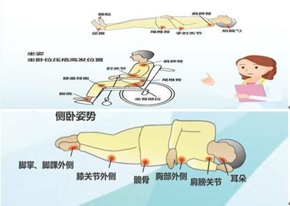 非感染性爛尾如何護(hù)理，“非感染性爛尾”如何護(hù)理