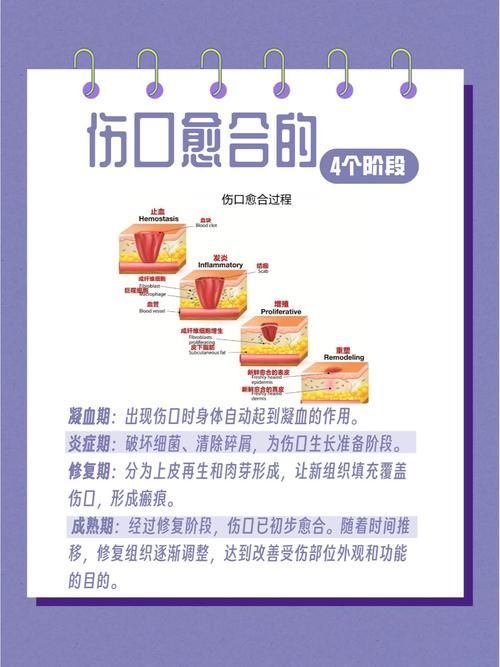 非感染性爛尾如何護(hù)理，“非感染性爛尾”如何護(hù)理
