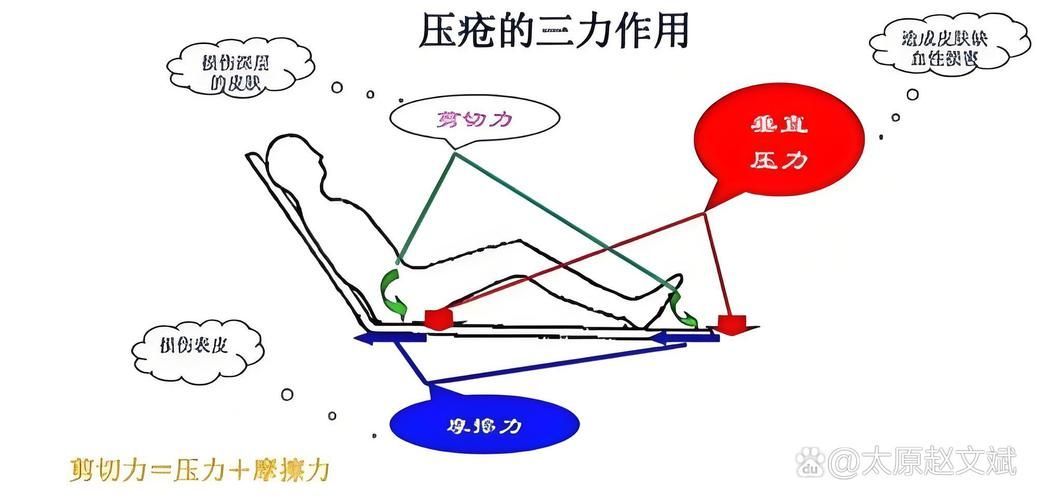 非感染性爛尾如何護(hù)理，“非感染性爛尾”如何護(hù)理
