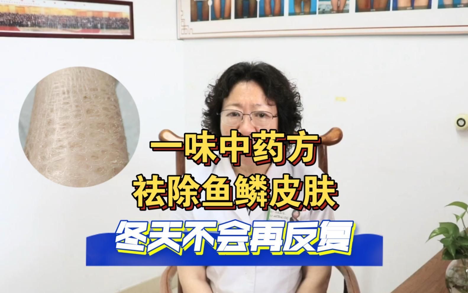 有哪些中藥可以輔助治療立鱗病，中醫(yī)治療立鱗病的方法