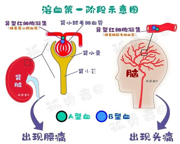 亞甲基藍和黃粉的副作用有哪些，亞甲基藍與黃粉的副作用