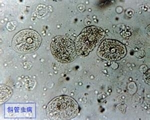銀龍魚身上有白疙瘩不是小瓜蟲怎么回事(銀龍魚身上長(zhǎng)白泡)