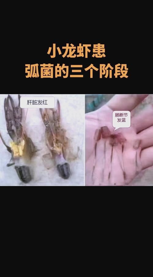 有沒有海洋弧菌感染的早期圖片？：創傷弧菌感染早期皮膚表現可通過以下圖片集直觀展示
