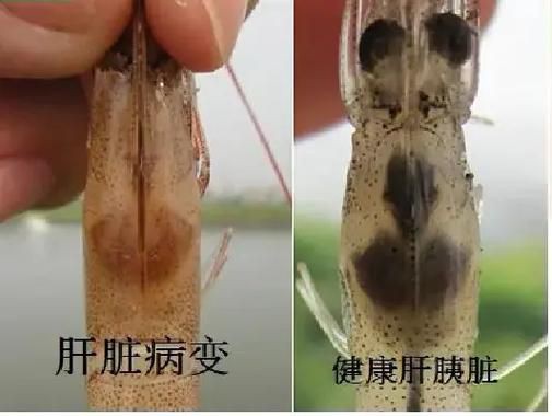 有沒有海洋弧菌感染的早期圖片？：創傷弧菌感染早期皮膚表現可通過以下圖片集直觀展示