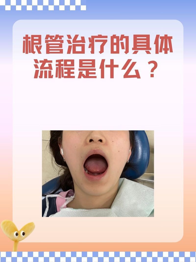 有沒有更詳細的治療步驟？：權威醫生專家意見以下是綜合多個高可信度來源整理的根管治療步驟 有沒有更詳細的治療步驟？：權威醫生專家意見以下是綜合多個高可信度來源整理的根管治療步驟 龍魚百科 第4張