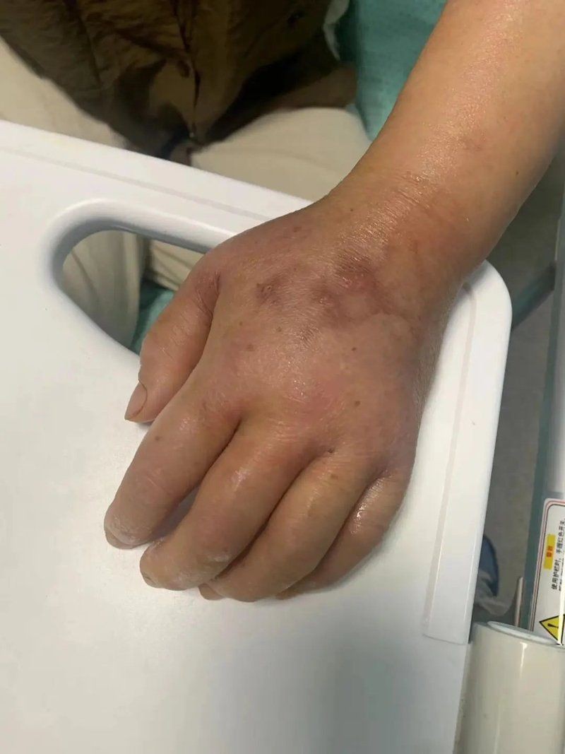海水魚細菌感染的死亡率有多高？：海水魚因細菌感染導致的死亡率受多重因素影響具有差異性 海水魚細菌感染的死亡率有多高？：海水魚因細菌感染導致的死亡率受多重因素影響具有差異性 龍魚百科 第1張