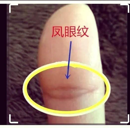 真正的龍眼紋【龍眼紋手相學解析龍眼紋與人體微觀命運的手相特征】