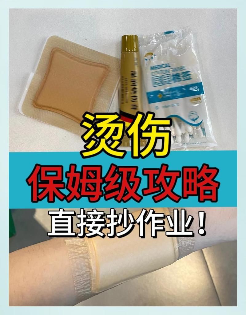 魚片燙5秒后如何處理降低風(fēng)險？【煎魚被油燙傷怎么處理】