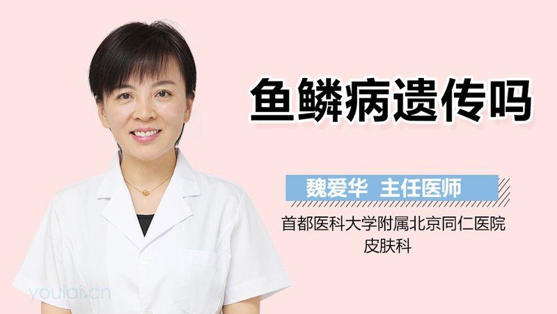 魚鱗病會遺傳給下一代嗎？【魚鱗病會遺傳下一代嗎劉鴻偉主任醫師三甲魚鱗病會遺傳嗎】