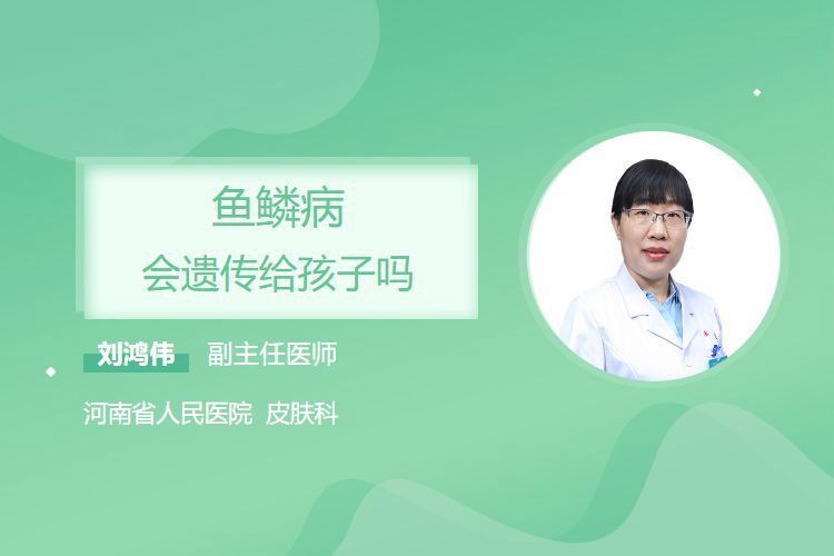 魚鱗病會遺傳給下一代嗎？【魚鱗病會遺傳下一代嗎劉鴻偉主任醫師三甲魚鱗病會遺傳嗎】