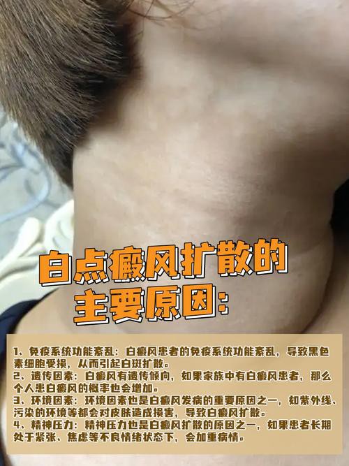 白點病初期圖片【寶寶脖子上有白色小圓點是怎么回事】
