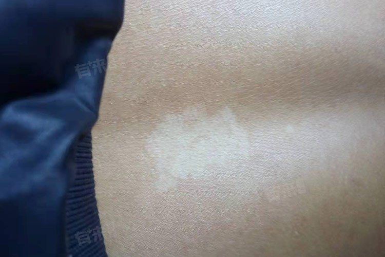 白點病會自愈嗎？【白點病會自愈嗎】 白點病會自愈嗎？【白點病會自愈嗎】 龍魚百科 第2張