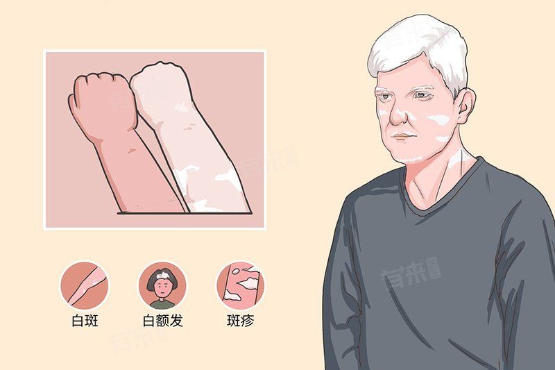 白點病會自愈嗎？【白點病會自愈嗎】 白點病會自愈嗎？【白點病會自愈嗎】 龍魚百科 第1張