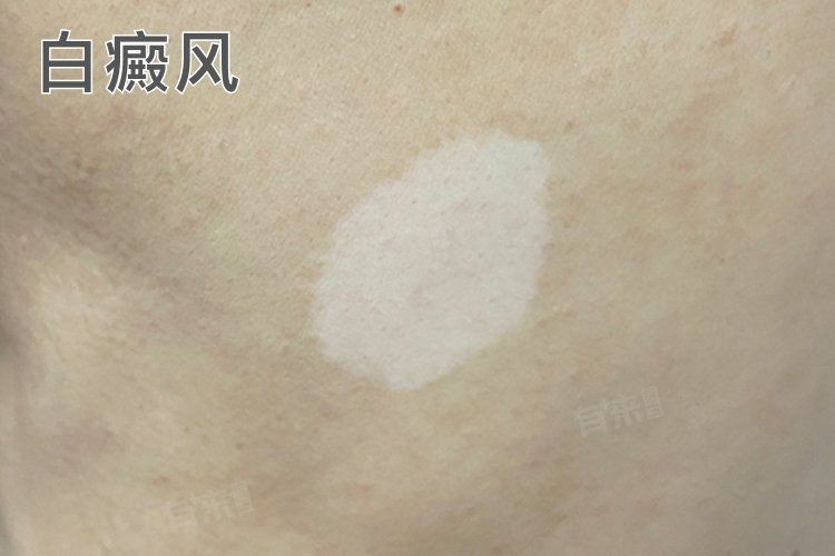 白點病有哪些典型癥狀？，什么是白點病