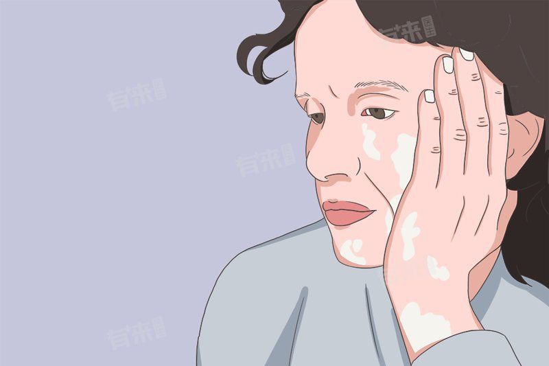 白點病有哪些典型癥狀？，什么是白點病
