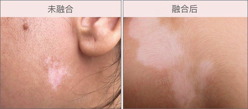 白點病有哪些典型癥狀？，什么是白點病