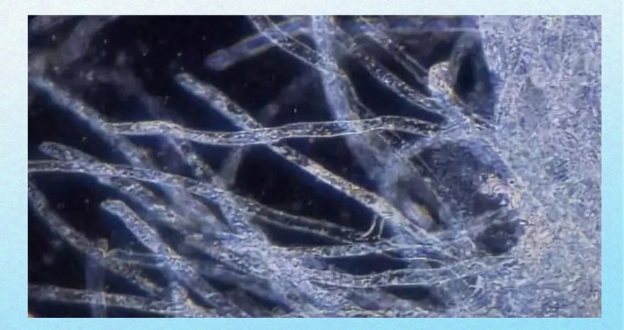 水霉病用高錳酸鉀管用嗎，水產衛士，為什么會得水霉病，如何防治