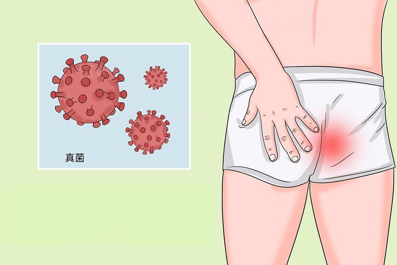 真菌感染后如何消毒，真菌感染了怎么辦