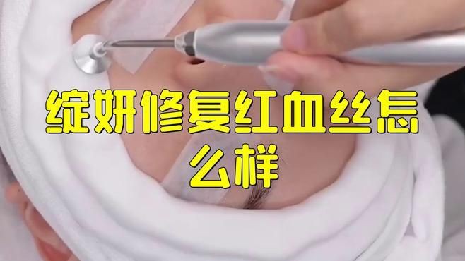 有哪些護膚品是專門針對紅血絲的？，南鳶鏡游公認好用的3款去紅修復面霜分享