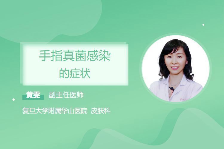 手部真菌感染的癥狀有哪些？，手上真菌感染的癥狀