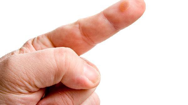 如何判斷龍魚傷口感染是否嚴重？，養魚小藝，如何判斷龍魚傷口感染的嚴重程度