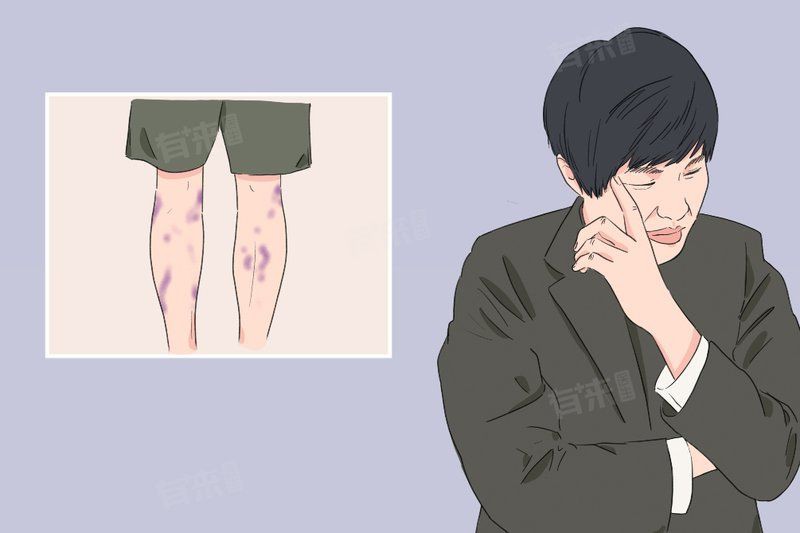 真菌在手上如何傳播，手上的真菌感染是怎么引起的