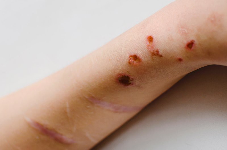 哪些龍魚品種易感染傳染病？，易感染傳染病的龍魚品種