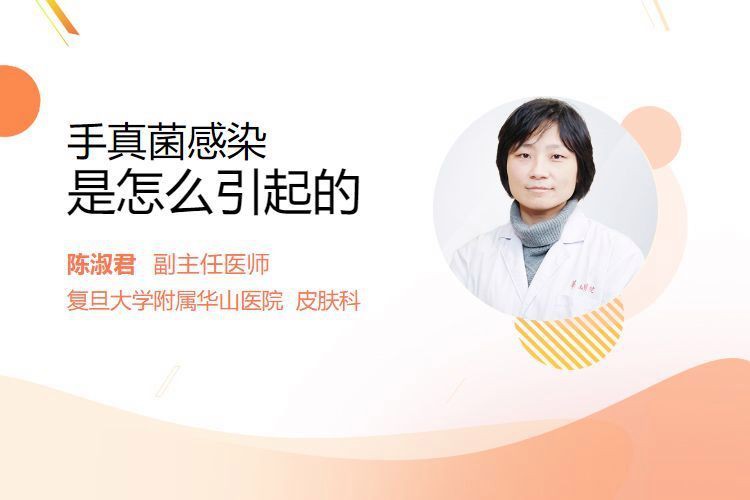 真菌在手上能存活多久，權威醫生專家意見真菌在手上存活時間受多種因素影響 真菌在手上能存活多久，權威醫生專家意見真菌在手上存活時間受多種因素影響 龍魚百科 第9張