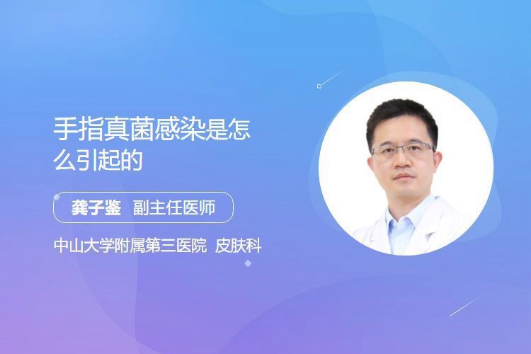 真菌在手上能存活多久，權威醫生專家意見真菌在手上存活時間受多種因素影響 真菌在手上能存活多久，權威醫生專家意見真菌在手上存活時間受多種因素影響 龍魚百科 第5張