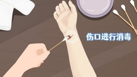 碘伏殘留如何徹底清除？，如何徹底清除碘伏殘留