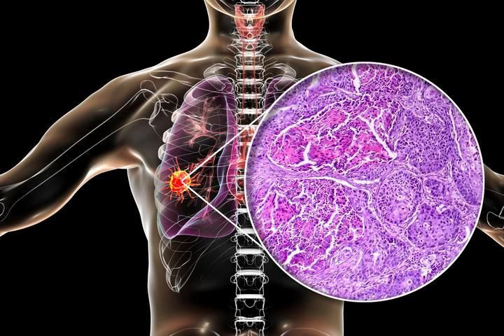 給我一份更詳細的治療方案,不同疾病類型的詳細治療方案 龍魚百科 第1張 給我一份更詳細的治療方案,不同疾病類型的詳細治療方案 給我一份更詳細的治療方案,不同疾病類型的詳細治療方案 龍魚百科 第1張