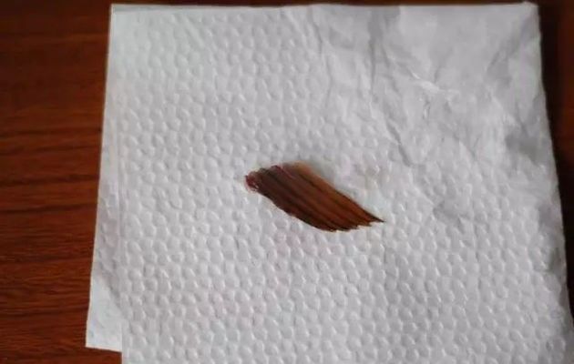 龍魚受到驚嚇不吃食怎么辦呀：龍魚因驚嚇停止進食怎么辦