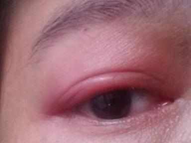 龍魚眼圈發(fā)紅什么原因：龍魚眼圈發(fā)紅可能是由多種原因引起的，龍魚眼圈發(fā)紅什么原因 龍魚眼圈發(fā)紅什么原因：龍魚眼圈發(fā)紅可能是由多種原因引起的，龍魚眼圈發(fā)紅什么原因 龍魚百科 第3張