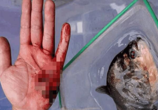 被金龙鱼咬了怎么办：被金龙鱼咬伤了怎么办