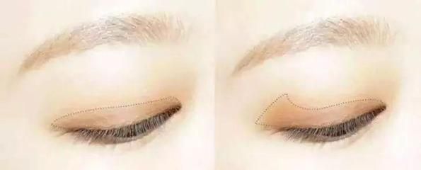 龍魚眼下垂怎么治療：龍魚眼下垂可能由多種原因引起，治療方法也有所不同