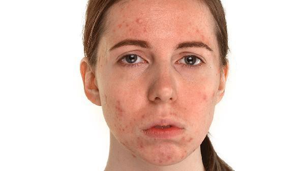 哪些因素會影響紅龍魚鰓蓋發色？ 哪些因素會影響紅龍魚鰓蓋發色？ 龍魚百科 第2張