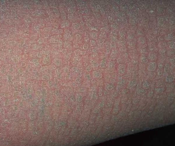 銀龍魚鱗片爛了怎么辦圖片大全 銀龍魚鱗片爛了怎么辦圖片大全 龍魚百科 第17張