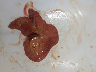 慶大霉素治龍魚腸炎嗎：慶大霉素可以治療龍魚腸炎嗎