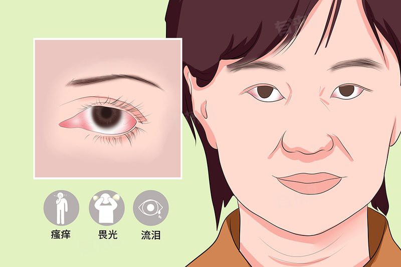 如何預防紅眼病的傳播？