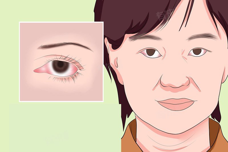 如何預防紅眼病的傳播？