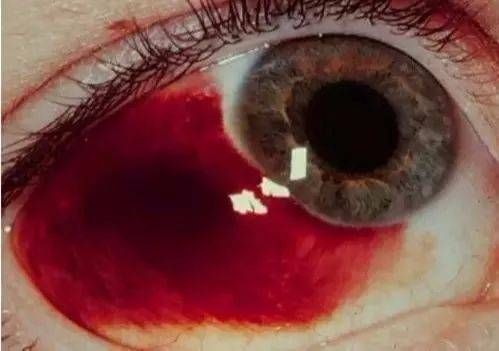 龍魚鱗下出血：龍魚鱗下出血可能是由多種原因引起的，治療方案需要注意 龍魚鱗下出血：龍魚鱗下出血可能是由多種原因引起的，治療方案需要注意 龍魚百科 第2張