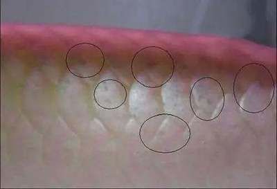 龍魚鱗片有小疙瘩能自愈嗎，：龍魚鱗片上出現小疙瘩能自愈嗎 龍魚鱗片有小疙瘩能自愈嗎，：龍魚鱗片上出現小疙瘩能自愈嗎 龍魚百科 第1張