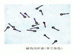 被龍魚咬后多久會安全？